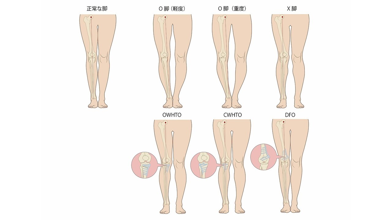 Implementation Manual